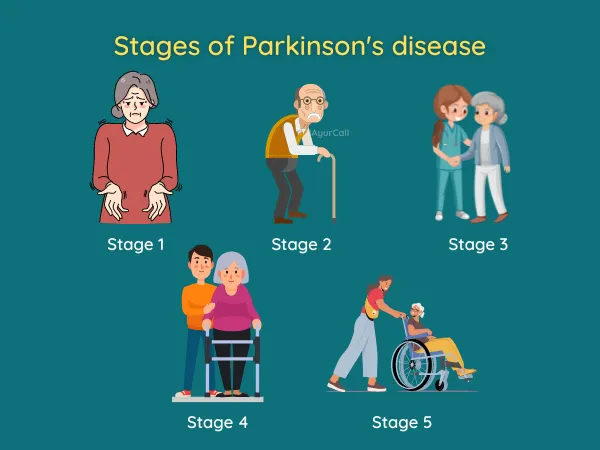 Stages of Parkinsons Disease